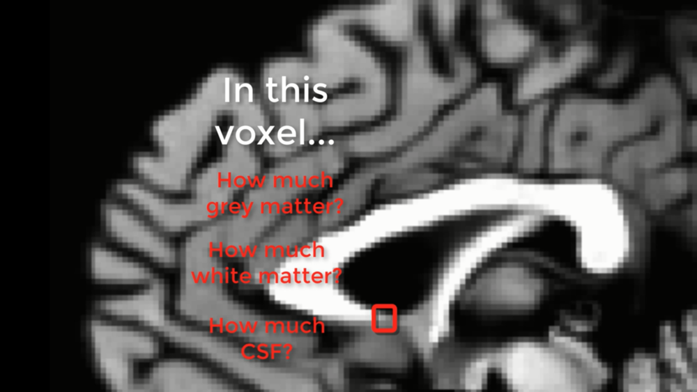 ../../_images/01_PartialVoluming_TissueTypes.png