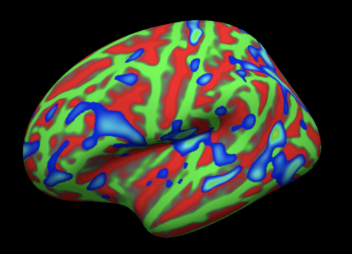../../_images/01_StatisticalMap_Surface.png