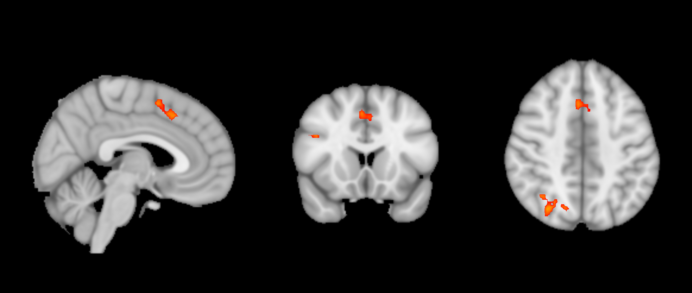 ../_images/3rdLevelAnalysis_ThresholdedStatsMontage.png