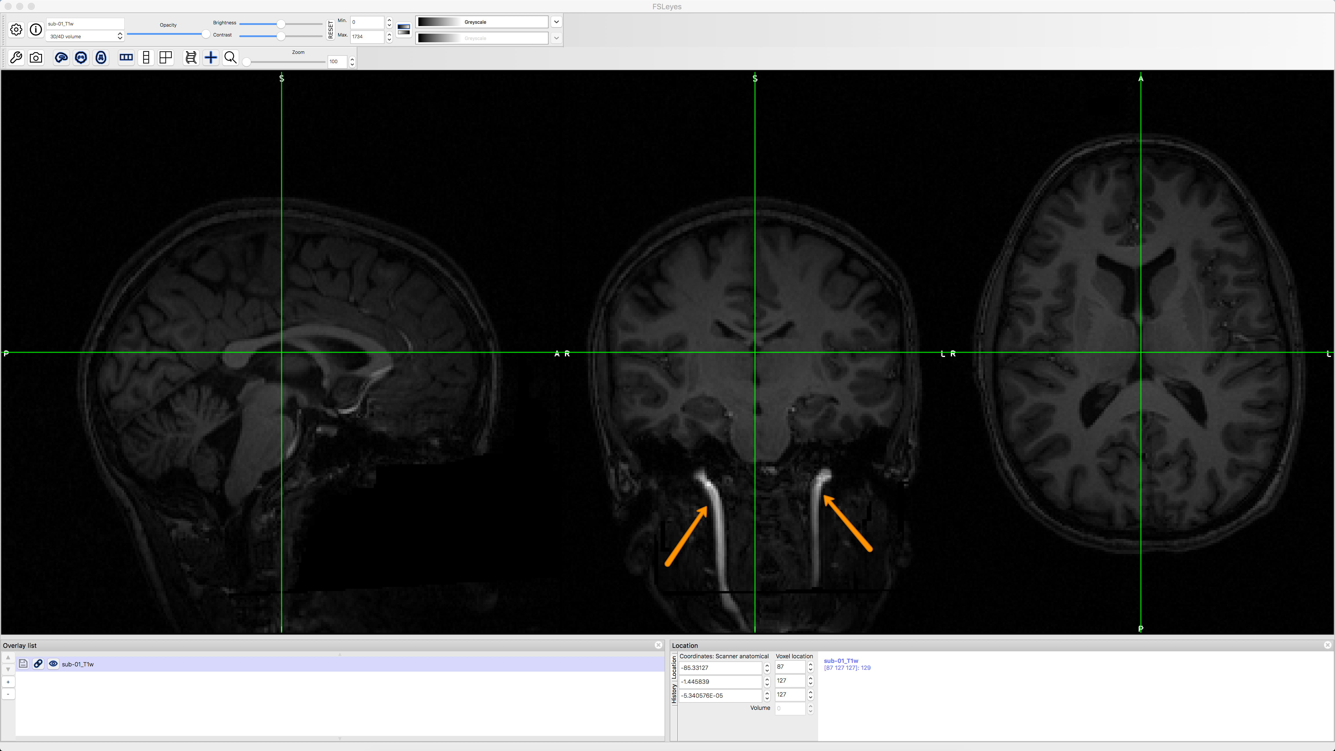 ../_images/anat_firstLook.png