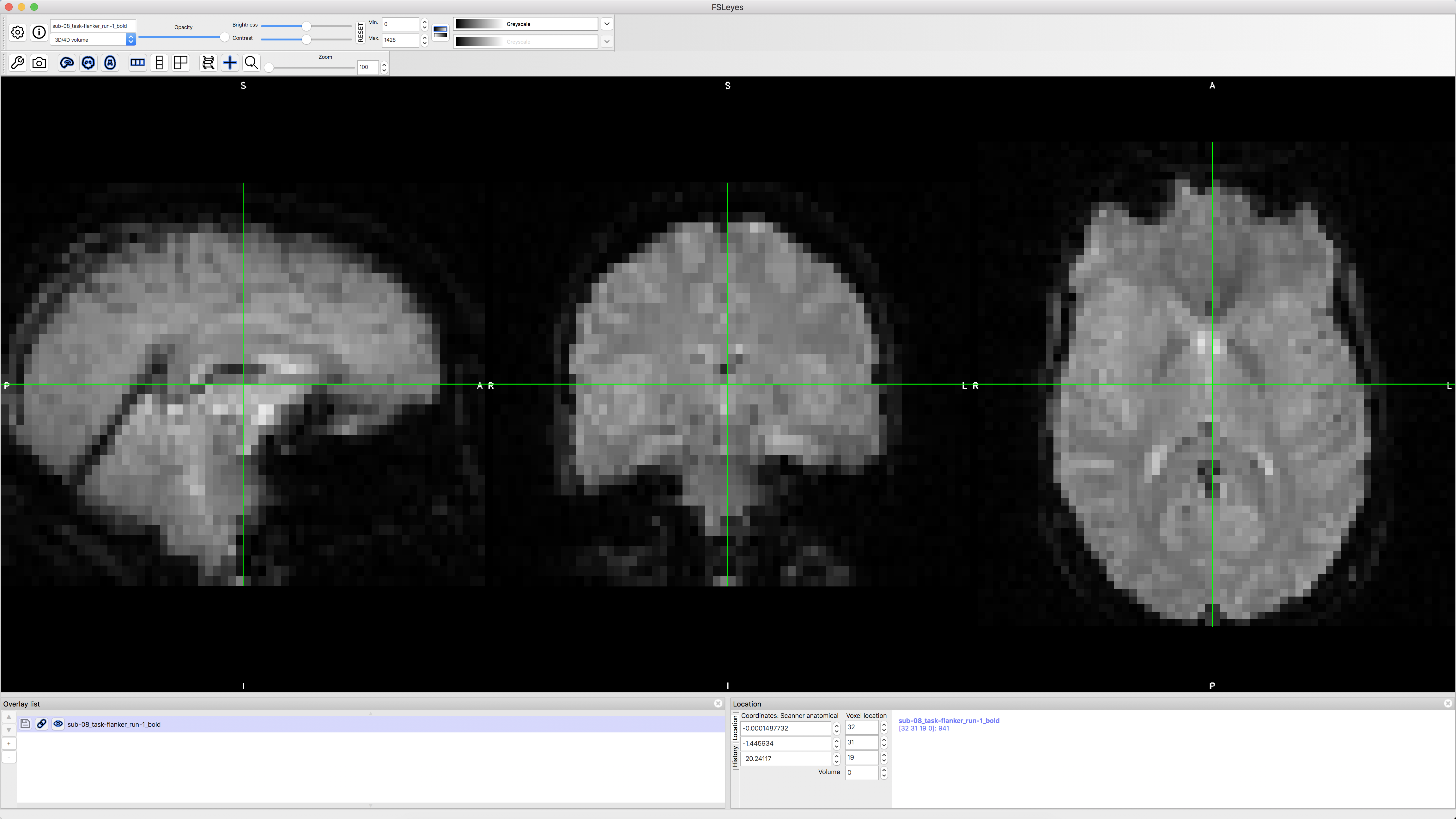 ../_images/functional_firstLook.png